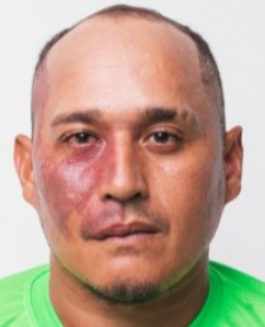 Franknilson Braga da Silva